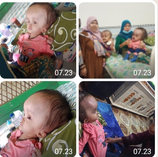 Gambar PT. Cemindo Gemilang Kembali Bantu Anak Penderita Hydrosefalus di Cihara 27