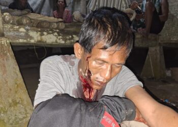 Pengojek di Pandeglang Jadi Korban Begal, Alami Luka Parah di Leher